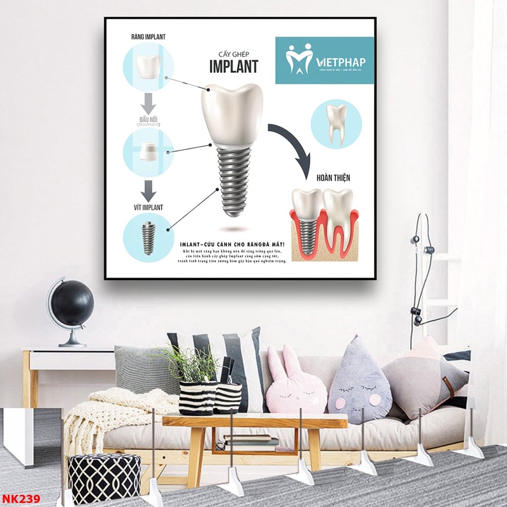 Tranh Treo Tường Nha Khoa Cấy Ghép IMPLANT